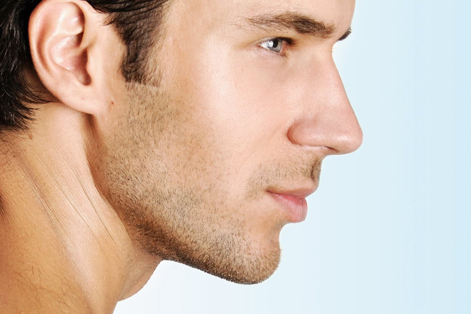 Kybella For Men Reduce A Double Chin Refine Your Jawline Kalos 