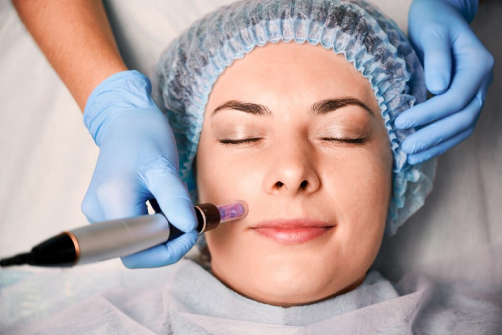 Woman getting a microneedling treatment at a physician-overseen medical spa